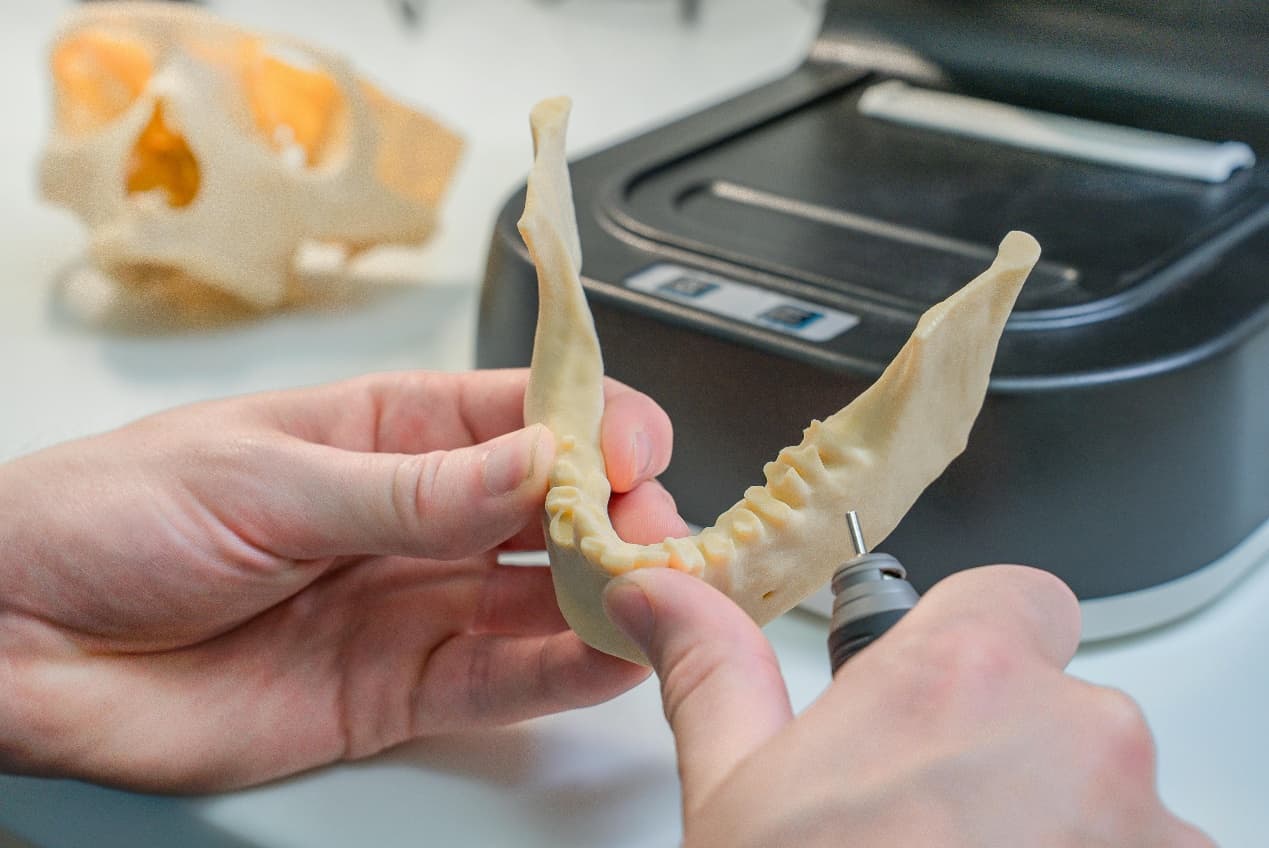 Technician inspecting a 3D printed dental jaw model