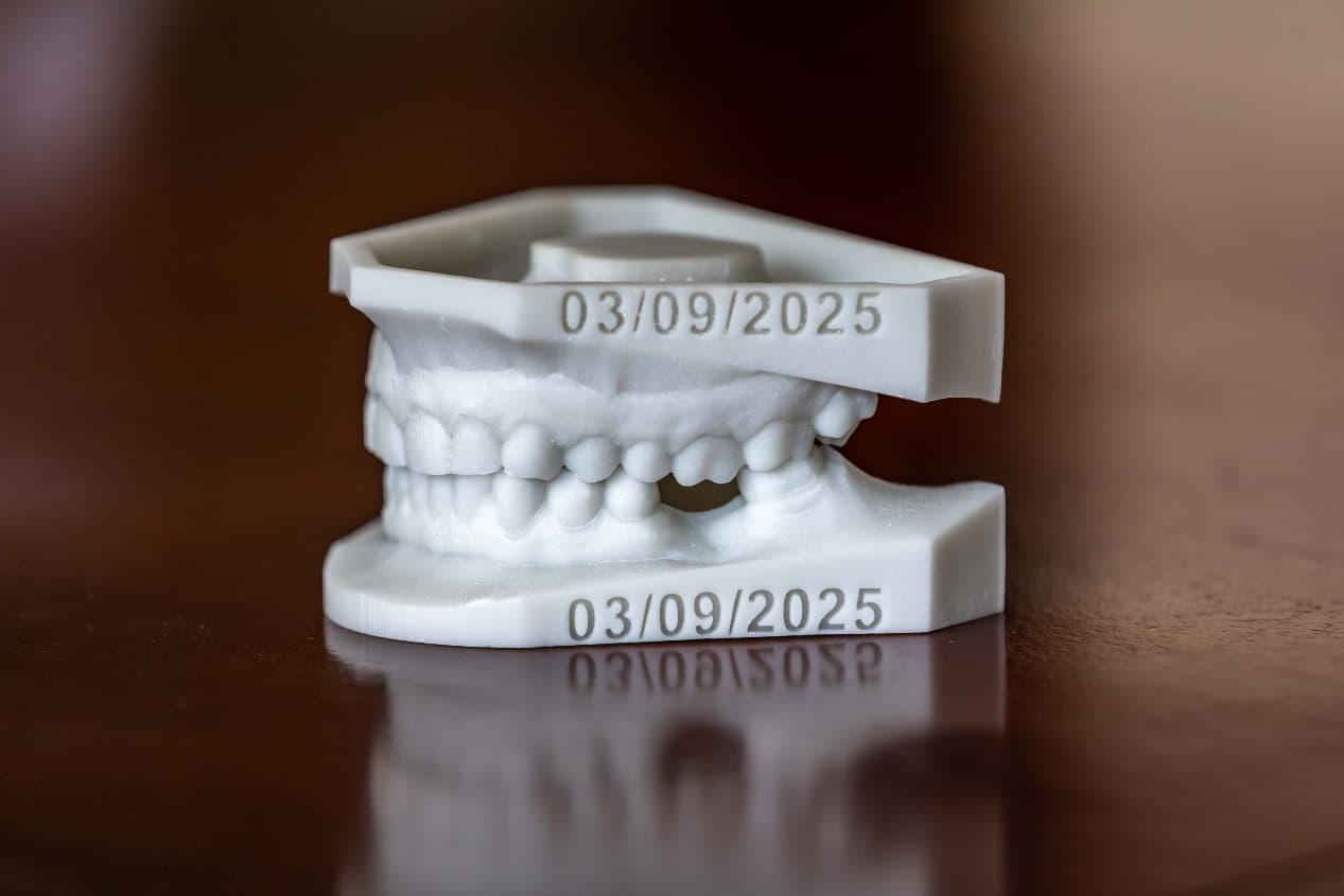 Dental model on a white surface showing tooth alignment